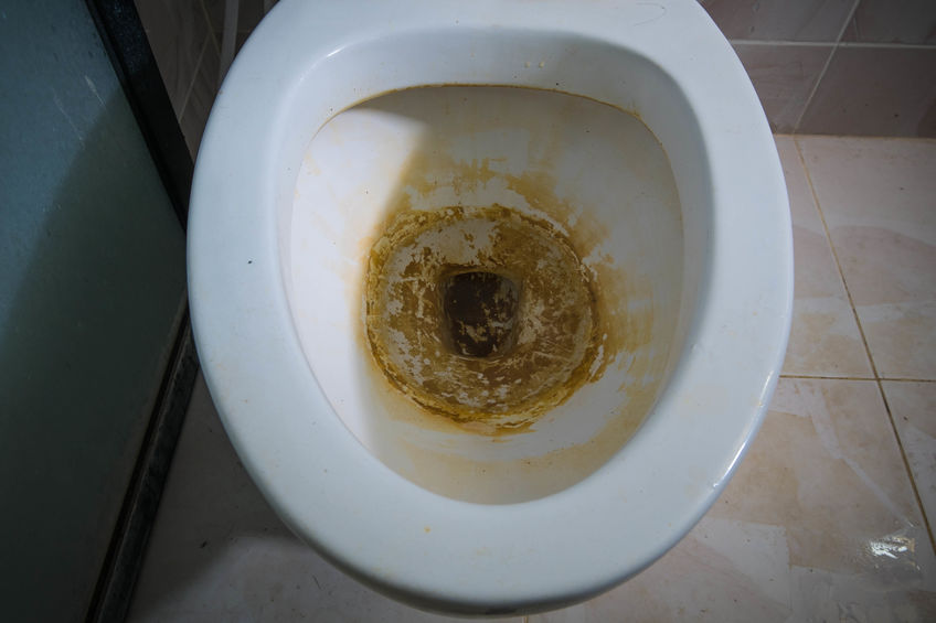 remove water stains in toilet